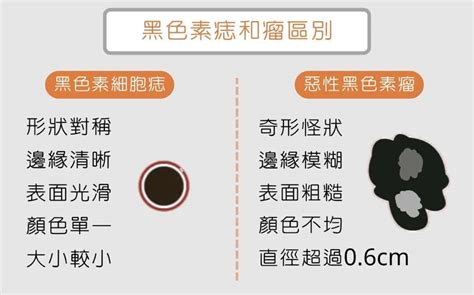 為何會長痣|為什麼臉上的痣越來越多？皮膚科醫師解析長痣原因、。